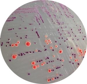 Evaluation de la gélose ChromAgar ACG